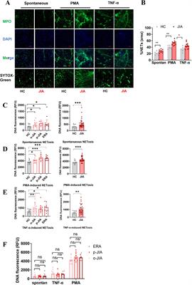 Increased neutrophil extracellular trap formation in oligoarticular, polyarticular juvenile idiopathic arthritis and enthesitis-related arthritis: biomarkers for diagnosis and disease activity